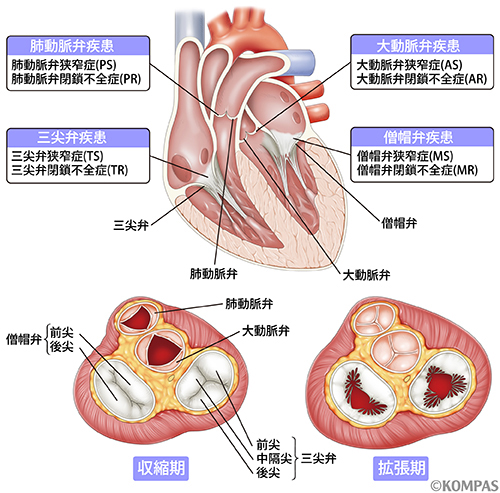 心臓 弁膜 症 手術