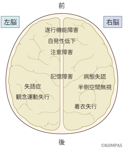 図1.　高次脳機能障害とその起こりやすい損傷部位