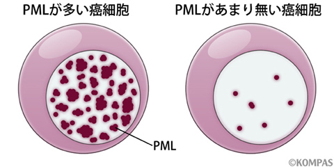 図2．PMLと癌細胞