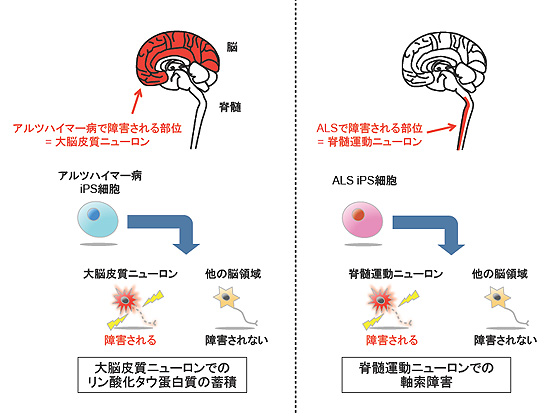 図2.神経疾患の領域特異的症状の再現