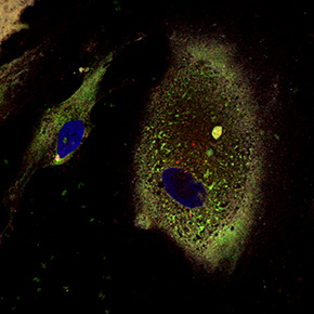 図２．患者iPS細胞から作製した内耳細胞（ペンドリンが蓄積している）