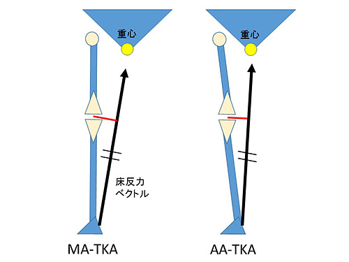 図５．TKA後の床反力ベクトルとレバーアーム