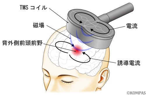 図1．TMSによる脳の局所刺激