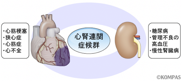 図3. 心腎連関症候群