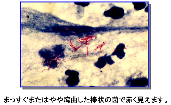 図１．顕微鏡で見た抗酸菌
