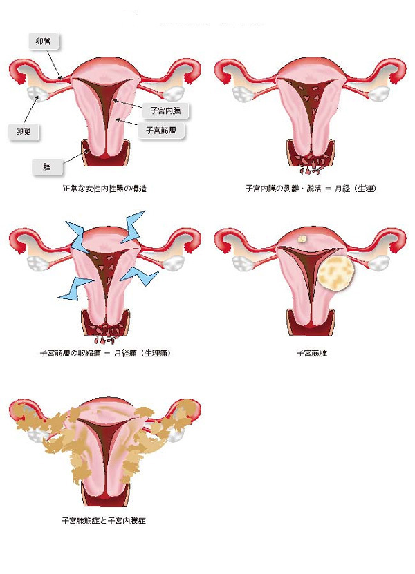 正常な女性内性器の構造と月経痛
