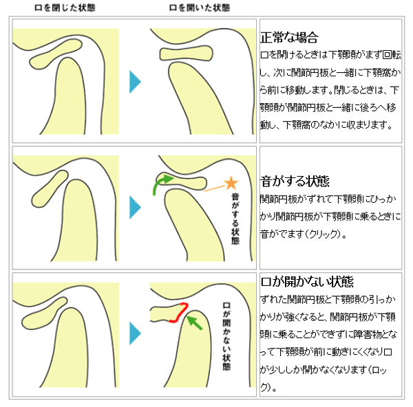 図２．顎関節の動き