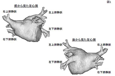 図１．CTスキャンから3次元的に作成した左心房