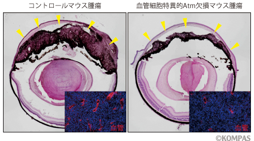 図2　がん血管におけるAtmの役割