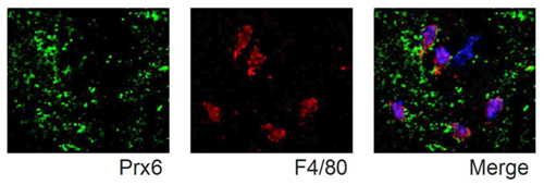 図4　Prxは細胞外に放出されてマクロファージを刺激する。