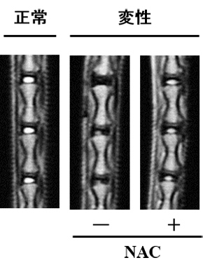 図４．ラット椎間板変性モデルのMRI画像