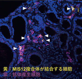  図1. シェーグレン症候群の唾液腺に存在するMIS12複合体に対する抗体を産生する細胞　(白矢印)