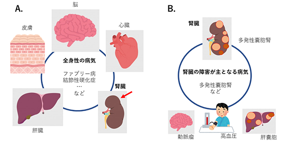 図1. 腎臓に症状が出る遺伝性の病気