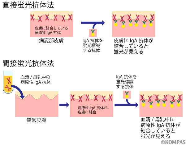 図1．蛍光抗体法