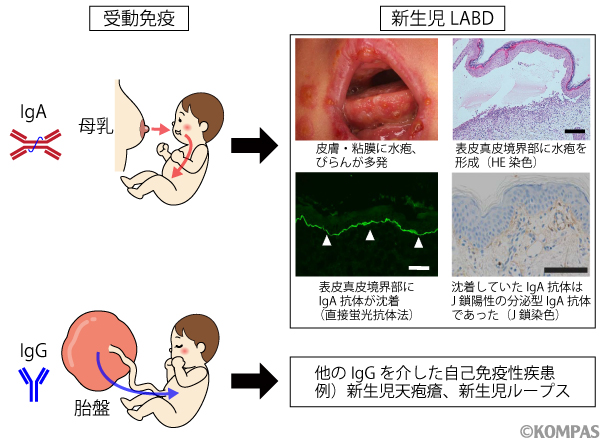 図2．受動免疫を介した新生児自己免疫性疾患の発症機序