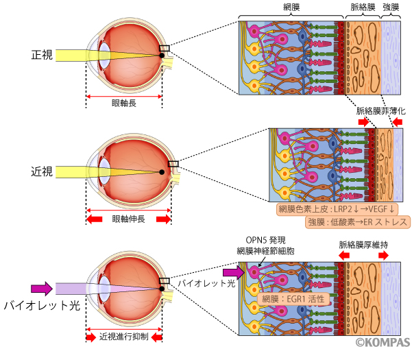 図２．網膜、脈絡膜、強膜それぞれを構成する細胞が関わる近視進行分子メカニズム