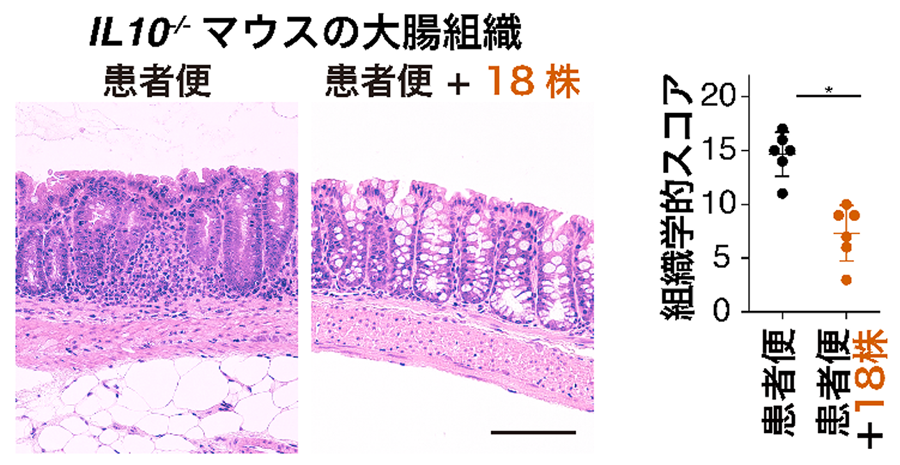 図２．<i>Il10<sup>-</sup>/</i><sup>-</sup>マウスの大腸組織