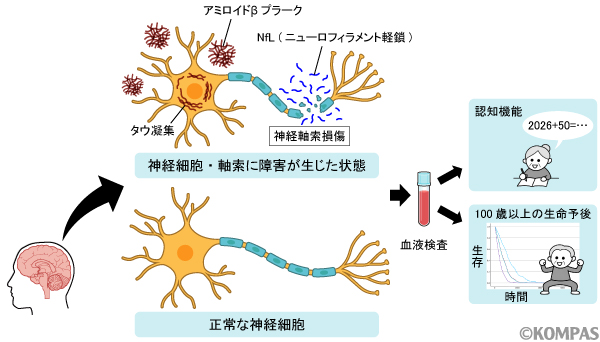 百寿者の認知機能と寿命を反映する血液バイオマーカーを特定